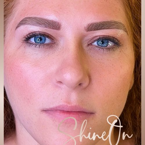 VC | Shine On | Before & Afters - 14